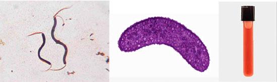 Rhodospirillum rubrum: two microscope images (the first an image of living cells and the second an image of fixed and stained bacteria) and a culture in a test tube.